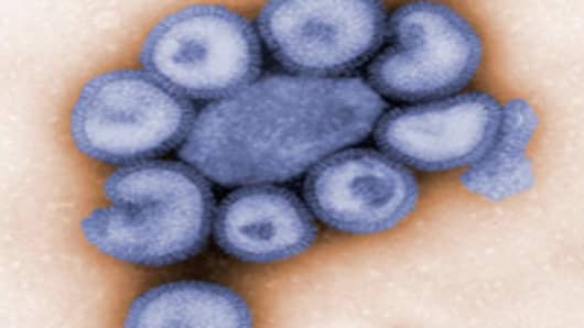 H1N1 strain of the swine flu virus.