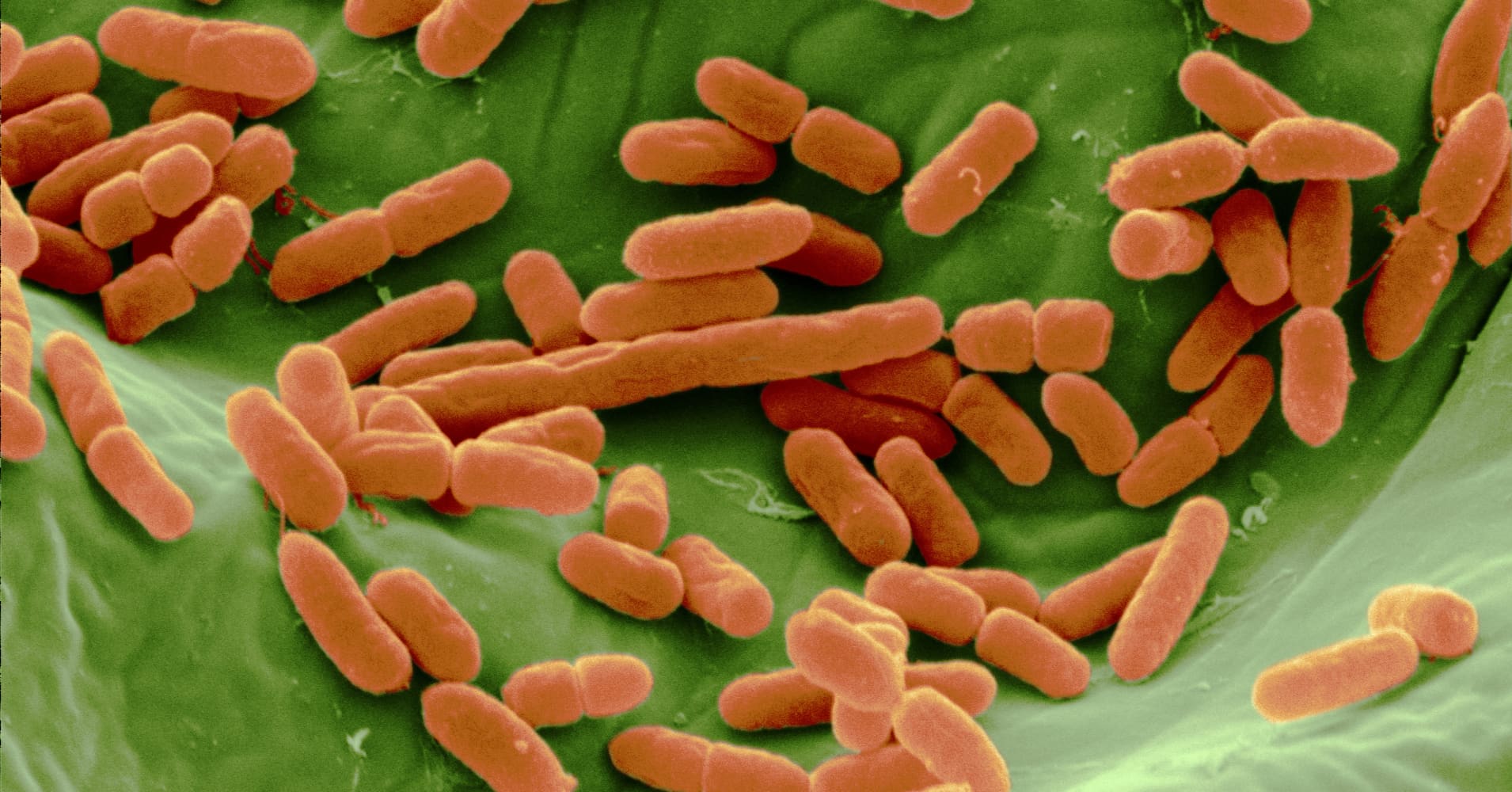 E. coli outbreak sickens 96 people across 5 states, CDC says
